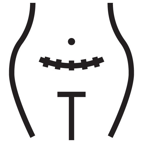 Cirugía Dermatológica